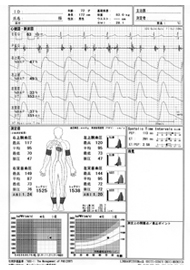 ABI・PWV検査