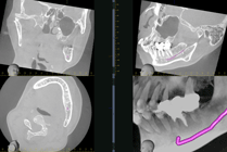 MRI