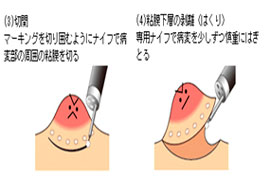 ダヴィンチ