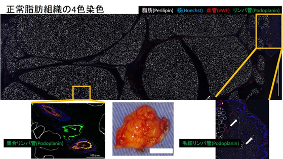 形成外科 診療内容 地方独立行政法人 総合病院 国保旭中央病院